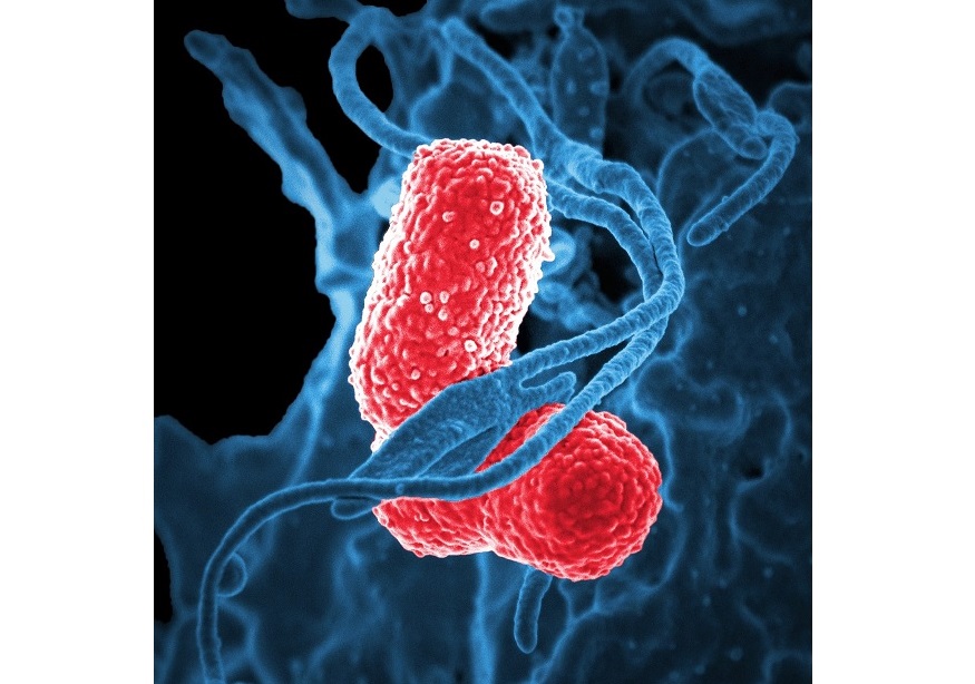 fiche-de-cours-exercices-devoirs-corriges-pdf-Collège-Troisième-générale-Science-de-la-vie-et-de-la-Terre-Microorganismes-et-infections